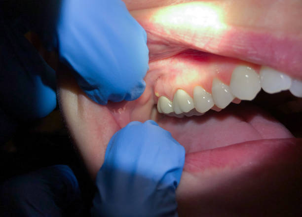 Best Pediatric Emergency Dentist in Serenada, TX