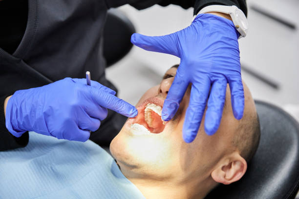Best Emergency Dentist for Knocked-Out Tooth in Serenada, TX